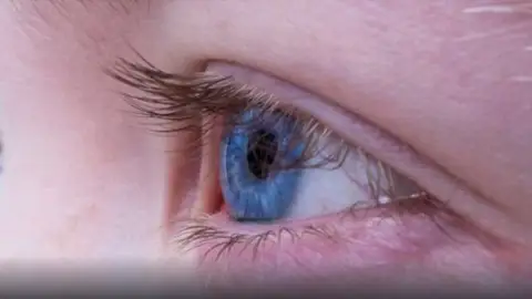 Terapia Visual Terapia Visual