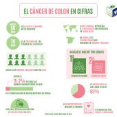 El cáncer de colon en cifras