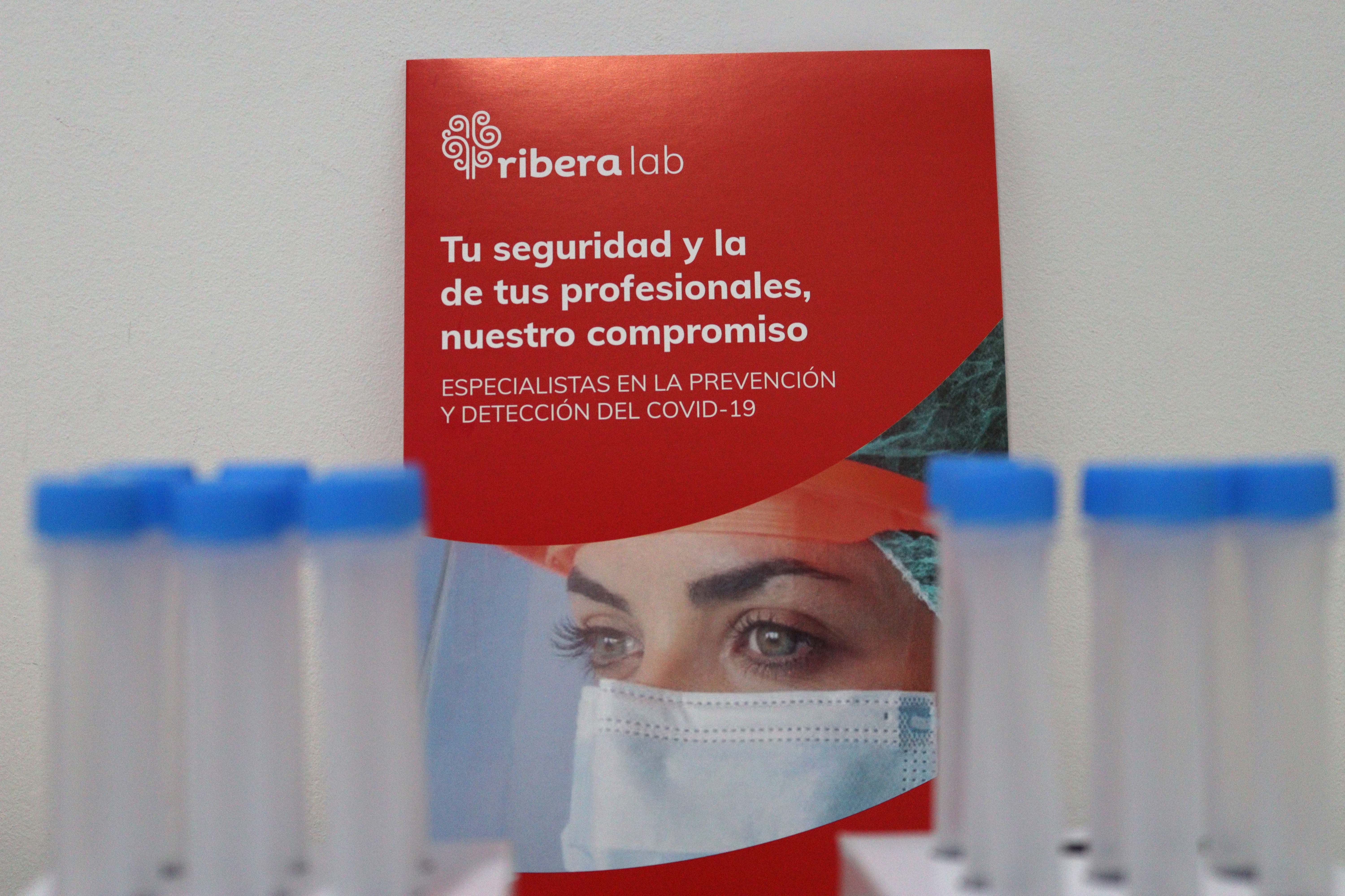 Se trata de una extracción de sangre convencional, no hace falta acudir en ayunas y los resultados se facilitan a las 48 horas desde la realización del test Se trata de una extracción de sangre convencional, no hace falta acudir en ayunas y los resultados se facilitan a las 48 horas desde la realización del test