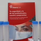 Se trata de una extracción de sangre convencional, no hace falta acudir en ayunas y los resultados se facilitan a las 48 horas desde la realización del test Se trata de una extracción de sangre convencional, no hace falta acudir en ayunas y los resultados se facilitan a las 48 horas desde la realización del test