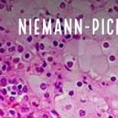 Enfermedad Niemann- Pick