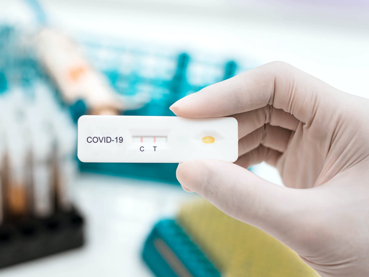 Las farmacias podrían contar con el permiso de venta sin receta de test de autodiagnóstico del virus Las farmacias podrían contar con el permiso de venta sin receta de test de autodiagnóstico del virus