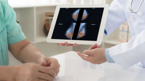 C&aacute;ncer de mama