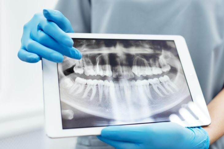 El 10% de la población infantil necesitó ortodoncia durante 2020 El 10% de la población infantil necesitó ortodoncia durante 2020