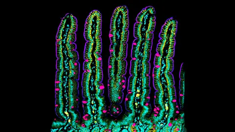 Descubren como se pliega y mueve la pared del intestino midiendo sus fuerzas Descubren como se pliega y mueve la pared del intestino midiendo sus fuerzas