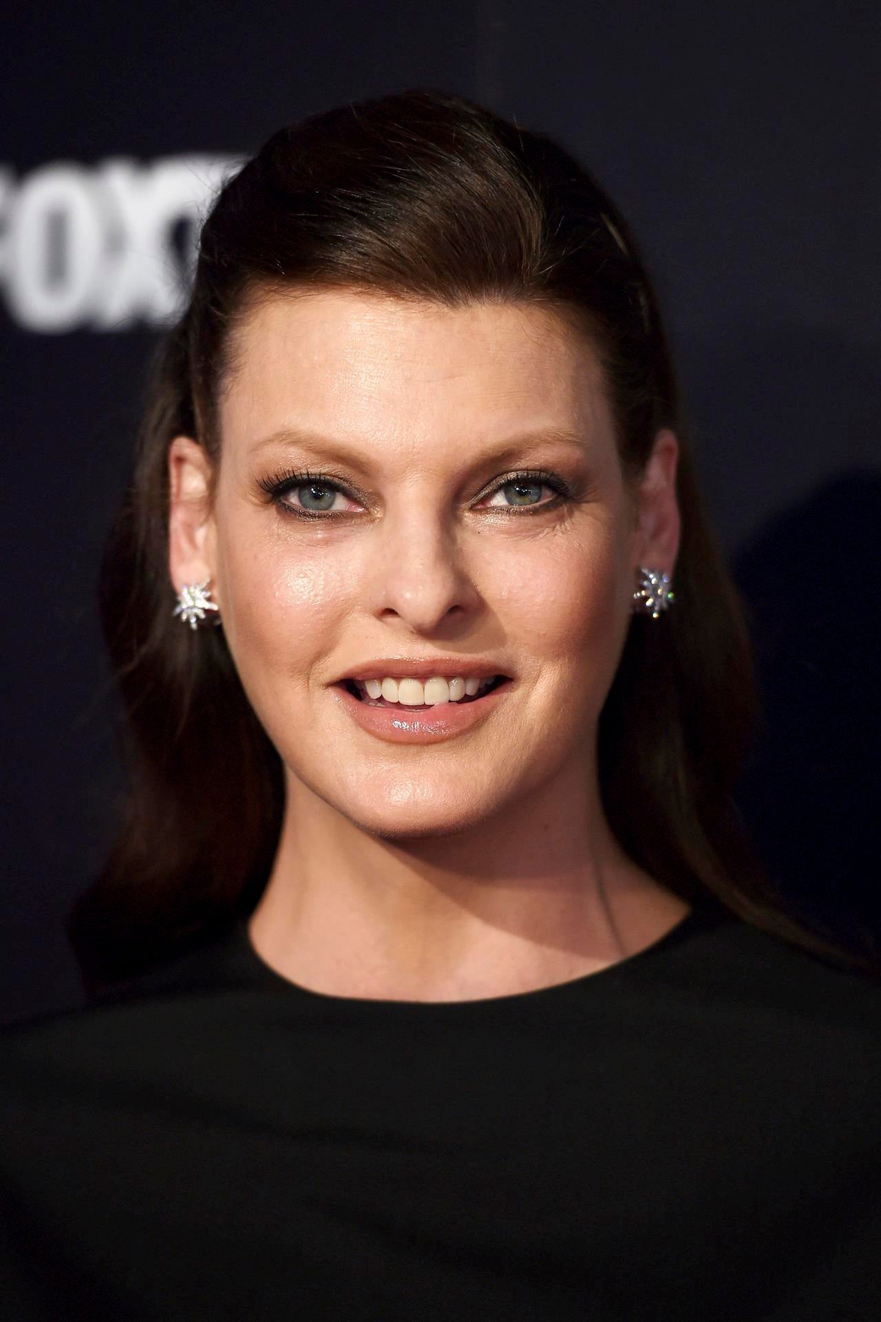 La modelo Linda Evangelista revela que padece de depresión después de quedar "desfigurada" por un tratamiento estético La modelo Linda Evangelista revela que padece de depresión después de quedar "desfigurada" por un tratamiento estético