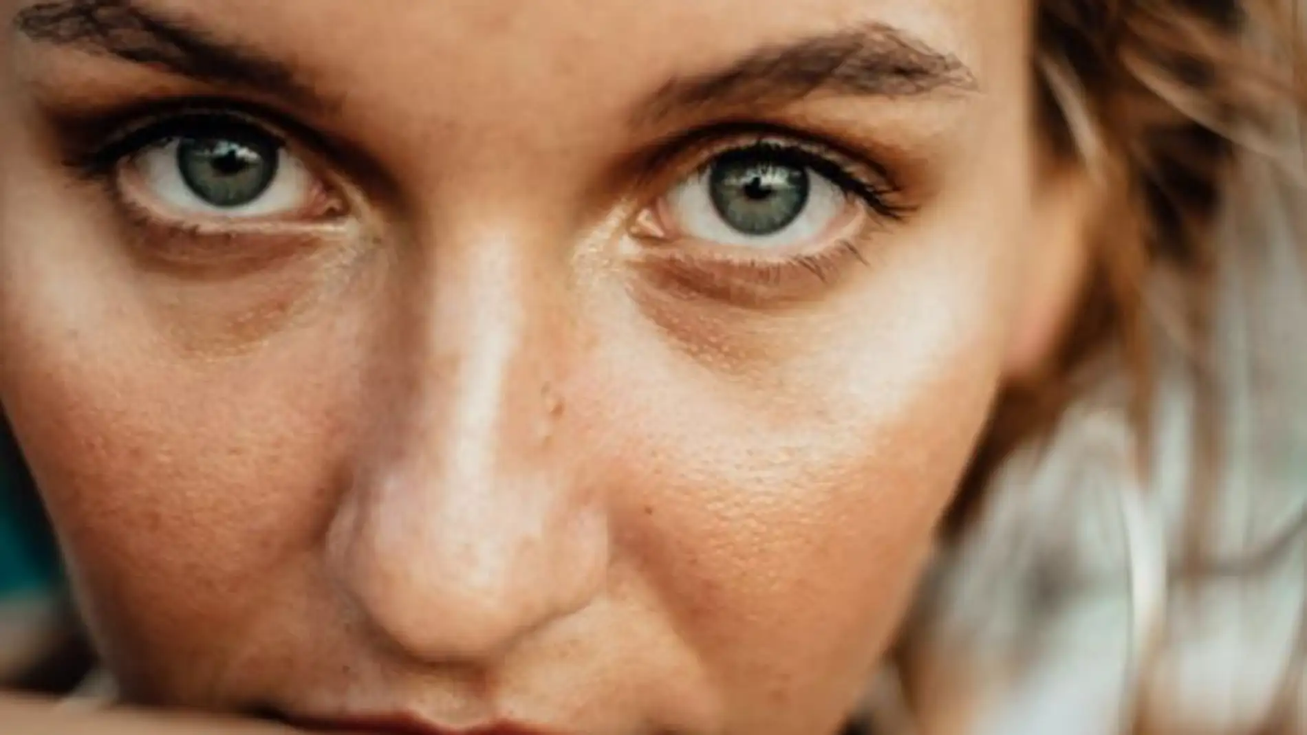 La lipoestructura facial permite mejorar la calidad de la piel en el contorno de los ojos