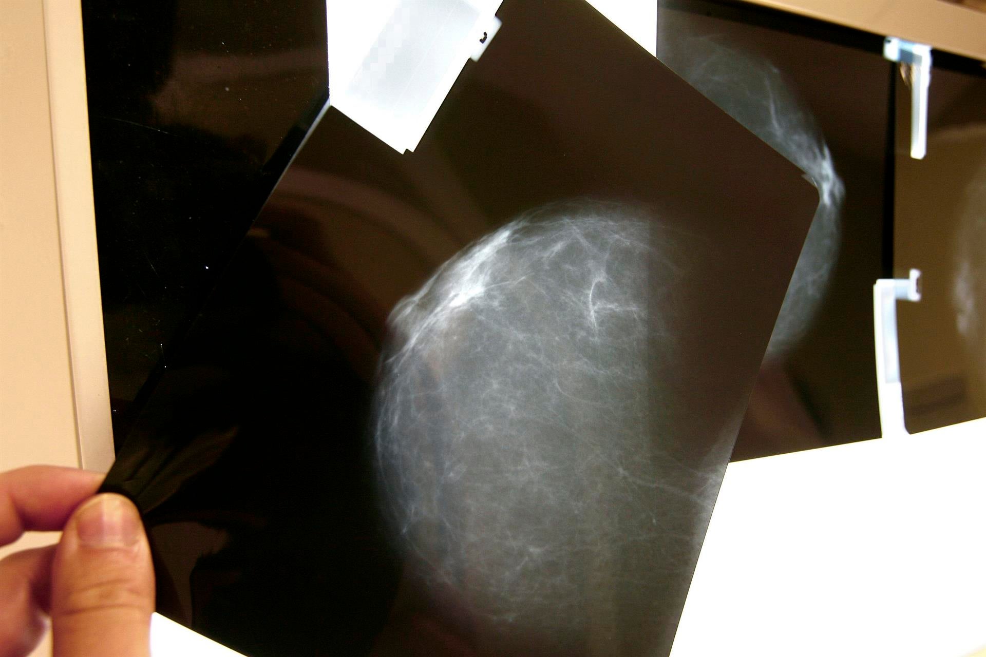 Día del Cáncer de Mama: ¿Por qué se celebra hoy 19 de octubre? Día del Cáncer de Mama: ¿Por qué se celebra hoy 19 de octubre?