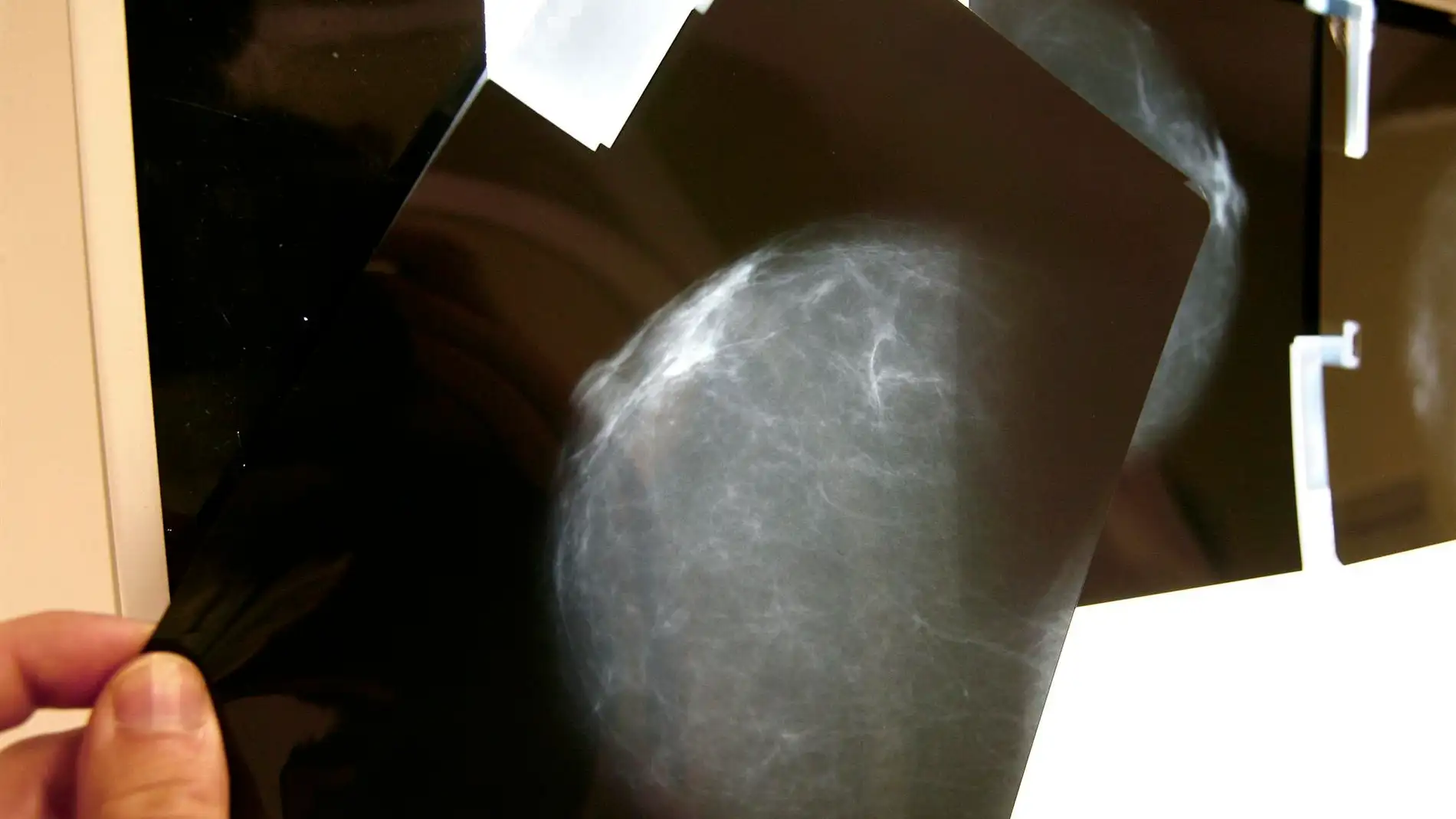 Día del Cáncer de Mama: ¿Por qué se celebra hoy 19 de octubre? Día del Cáncer de Mama: ¿Por qué se celebra hoy 19 de octubre?