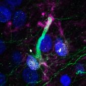 Una célula madre neural en el hipocampo humano adulto