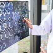 Doctor mira la resonancia magnética del cerebro de un paciente