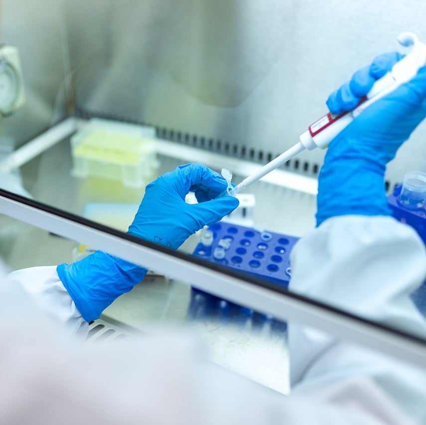 Aragón tiene preparados los protocolos frente al Marburgo Aragón tiene preparados los protocolos frente al Marburgo