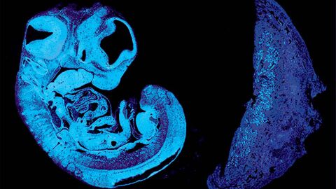 Secci&oacute;n de un feto de rat&oacute;n y la placenta
