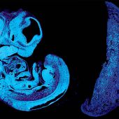 Sección de un feto de ratón y la placenta