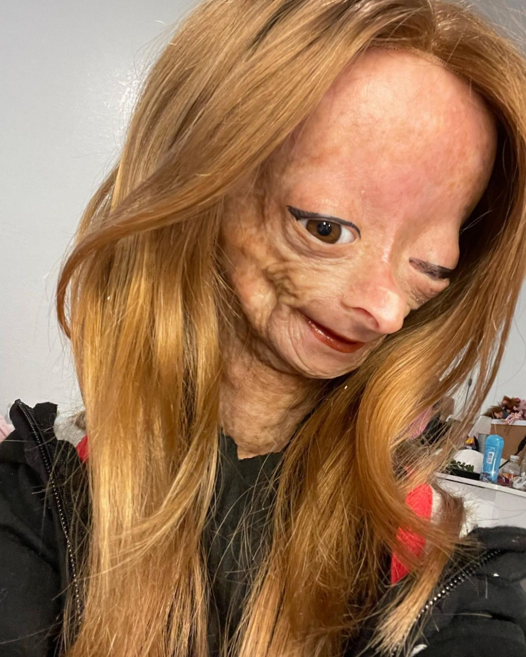 Muere Adalia Rose Williams, la joven youtuber cuya enfermedad inspiró la película de Benjamin Button Muere Adalia Rose Williams, la joven youtuber cuya enfermedad inspiró la película de Benjamin Button