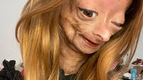Muere Adalia Rose Williams, la joven youtuber cuya enfermedad inspiró la película de Benjamin Button Muere Adalia Rose Williams, la joven youtuber cuya enfermedad inspiró la película de Benjamin Button