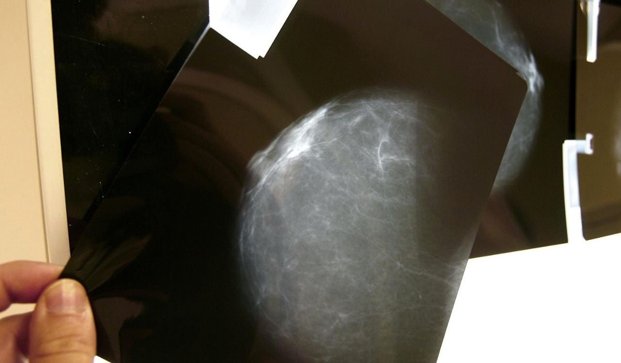¿Cómo ha afectado la pandemia al diagnóstico del cáncer y a los pacientes oncológicos? ¿Cómo ha afectado la pandemia al diagnóstico del cáncer y a los pacientes oncológicos?
