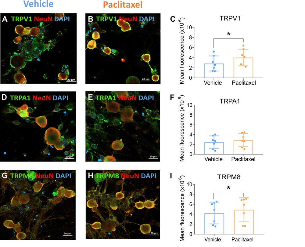 Un estudio de la UMH de Elche apunta que los derivados no abrasivos de la capsaicina pueden aliviar los síntomas de la neuropatía por quimioterapia Un estudio de la UMH de Elche apunta que los derivados no abrasivos de la capsaicina pueden aliviar los síntomas de la neuropatía por quimioterapia