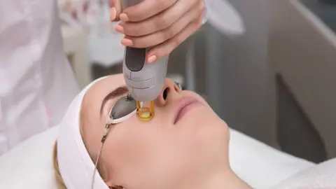 Láser manchas Láser manchas