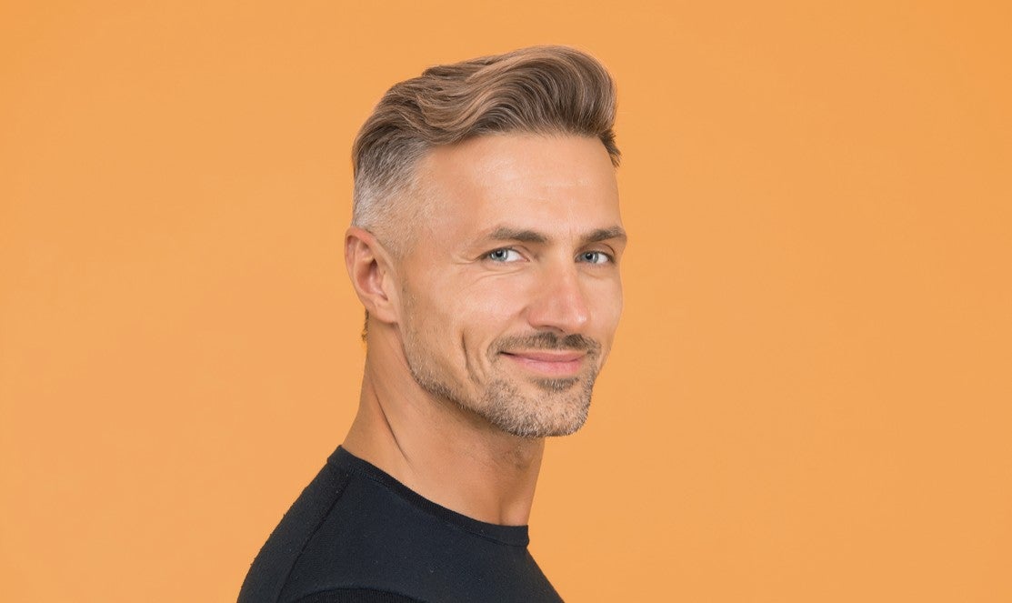 Consigue una apariencia de naturalidad y pelo abundante con la microcirugía capilar FUE en Centro Dermatológico Estético Consigue una apariencia de naturalidad y pelo abundante con la microcirugía capilar FUE en Centro Dermatológico Estético