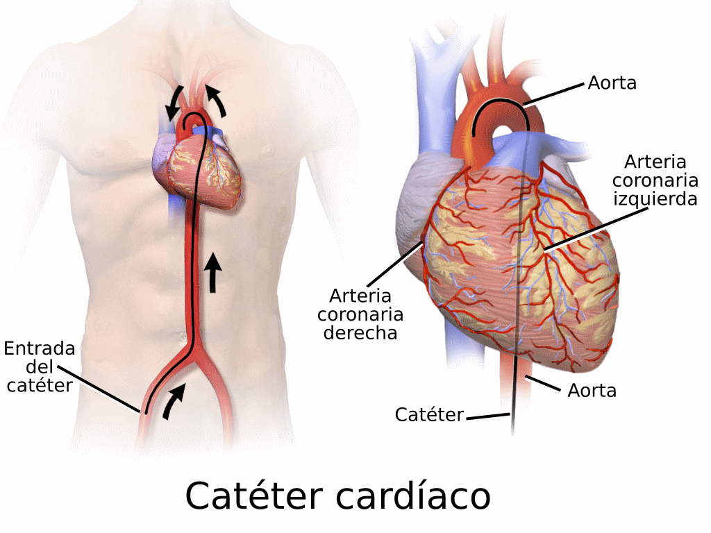 Más de 100.000 cateterismos Más de 100.000 cateterismos