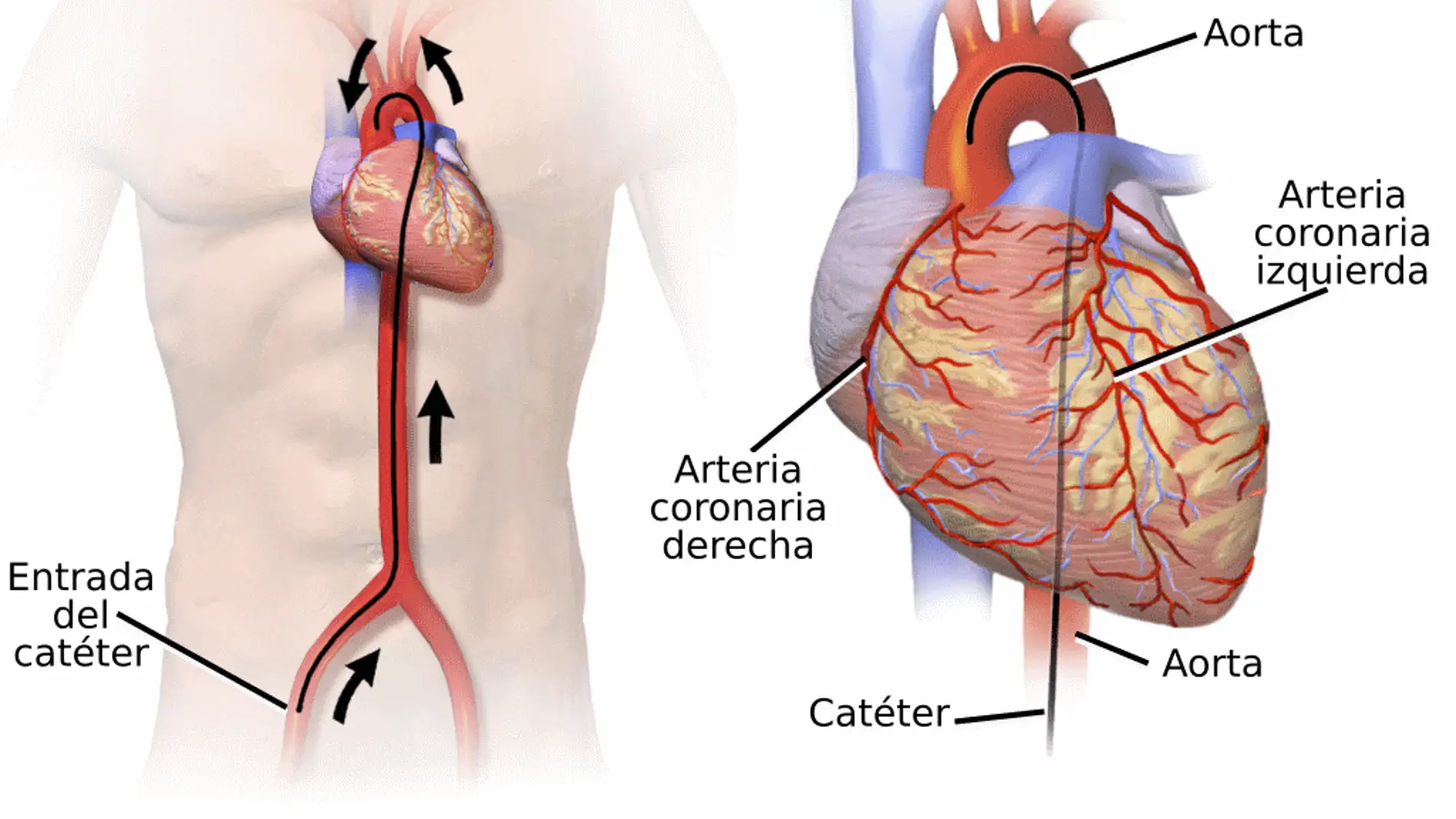 Más de 100.000 cateterismos en el Hospital Reina Sofía Más de 100.000 cateterismos en el Hospital Reina Sofía