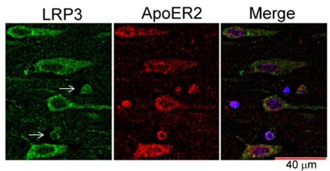 Investigadores del Instituto de Neurociencias de la UMH de Elche descubren una proteína que protege al cerebro del Alzheimer Investigadores del Instituto de Neurociencias de la UMH de Elche descubren una proteína que protege al cerebro del Alzheimer