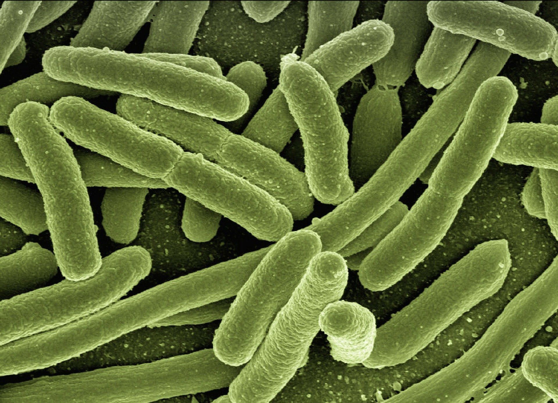 Ciencia en La Brújula: ¿Por qué las bacterias suelen ser muy pequeñas? episode artwork