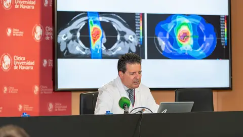 Javier Aristu Director Clínico Unidad de Protonterapia