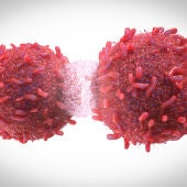Células cancerosas