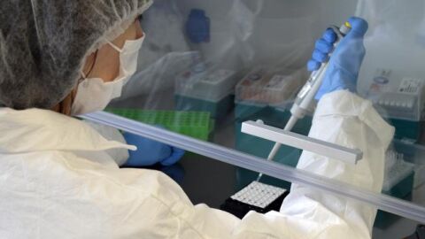 &iquest;C&oacute;mo prevenir la viruela del mono?