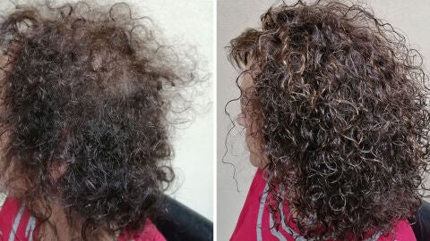 Cuando la escasez de cabello en la mujer es ya irreversible Grasman nos ofrece una soluci&oacute;n: el Volumater