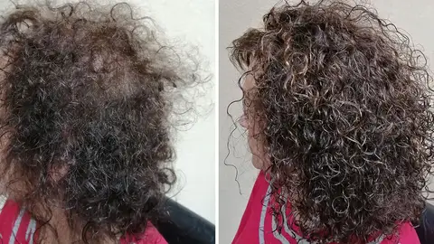 Cuando la escasez de cabello en la mujer es ya irreversible Grasman nos ofrece una solución: el Volumater Cuando la escasez de cabello en la mujer es ya irreversible Grasman nos ofrece una solución: el Volumater