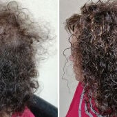Cuando la escasez de cabello en la mujer es ya irreversible Grasman nos ofrece una solución: el Volumater