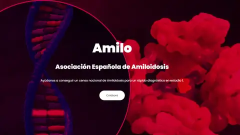Asociación Española de Amiloidosis Asociación Española de Amiloidosis