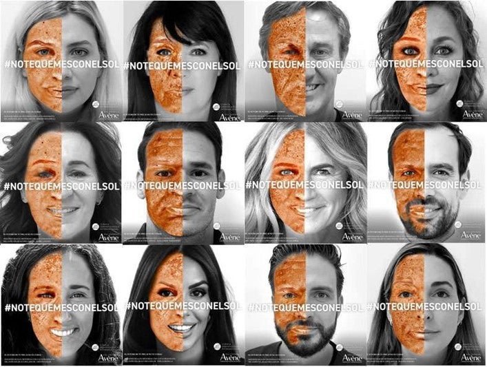 El Ruber Internacional se une a la campaña «No te quemes con el sol». El Ruber Internacional se une a la campaña «No te quemes con el sol».