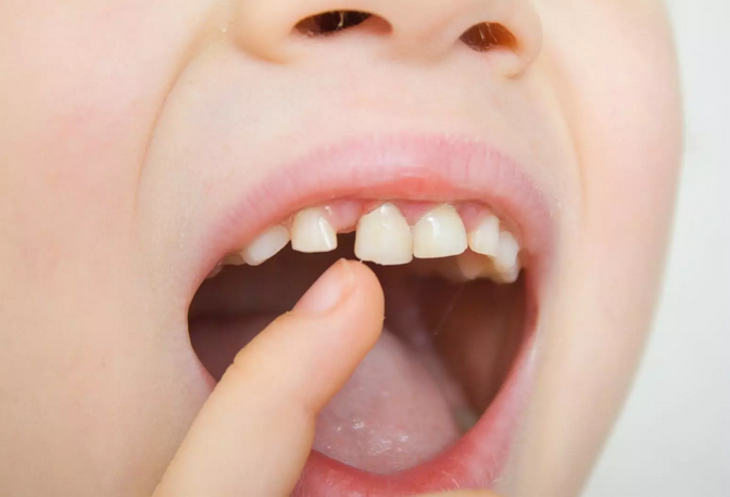 El Ministerio destina más de 1,7 millones a la Región de Murcia para la ampliación de los servicios de Salud Bucodental El Ministerio destina más de 1,7 millones a la Región de Murcia para la ampliación de los servicios de Salud Bucodental