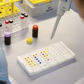 Sanidad precisa que no se trata de un caso de cólera sino de gastroenteritis Sanidad precisa que no se trata de un caso de cólera sino de gastroenteritis