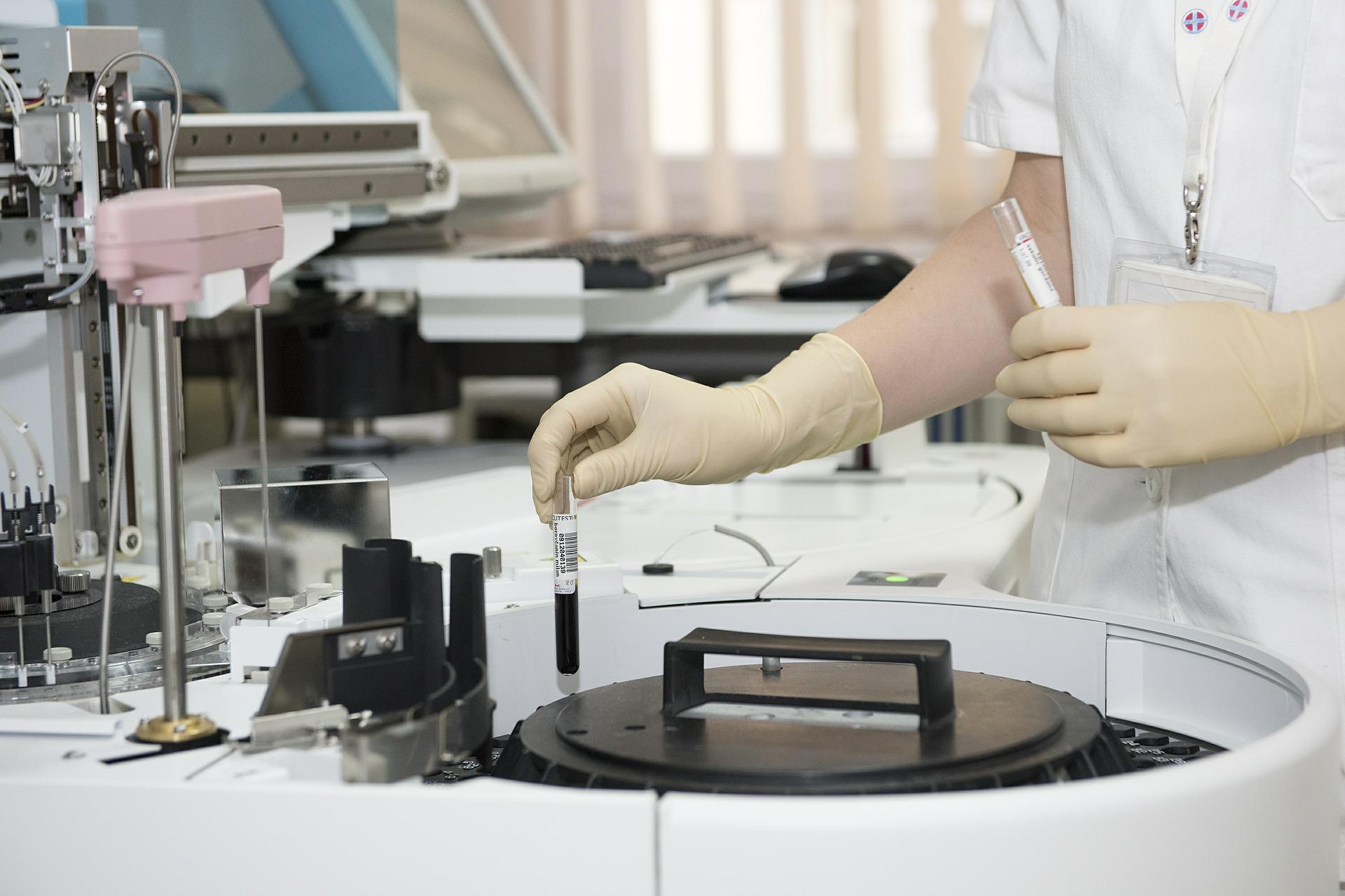 ¿Qué es la gastroenteritis por Vibrio Cholerae? ¿Qué es la gastroenteritis por Vibrio Cholerae?