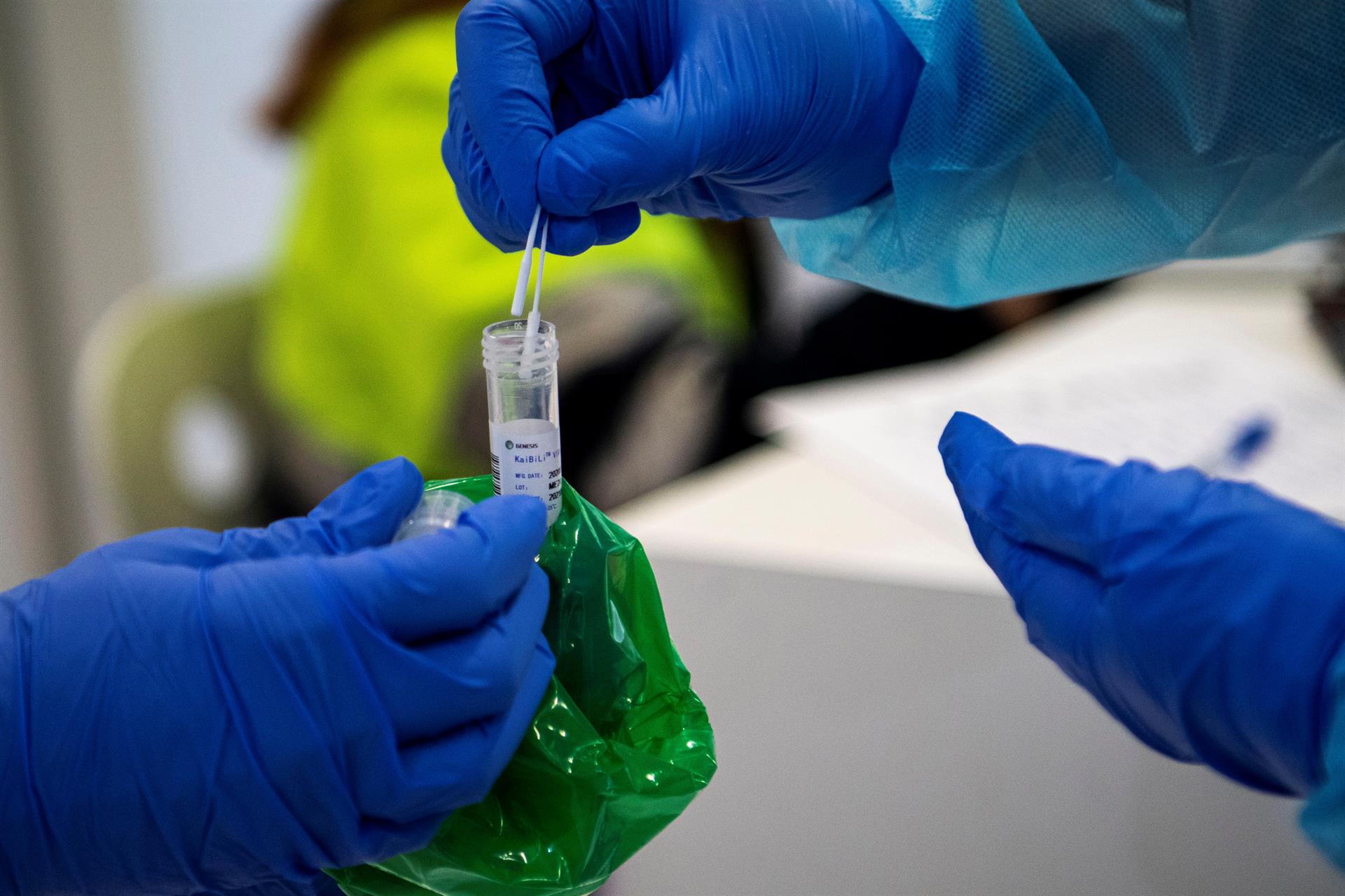 Estos son los síntomas del Covid-22 que ha provocado la séptima ola Estos son los síntomas del Covid-22 que ha provocado la séptima ola