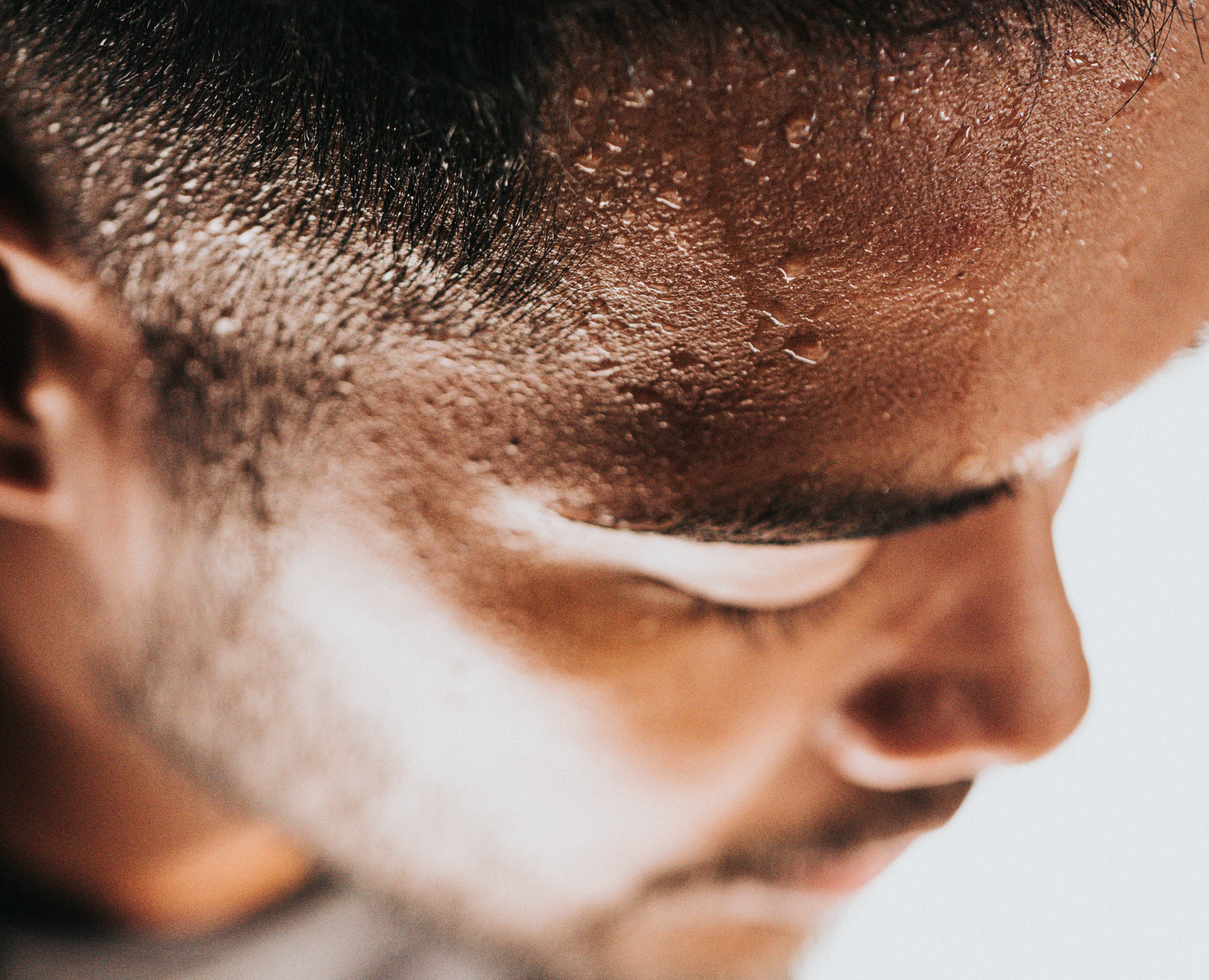 ¿Alergia al sudor? Por qué se produce y cuáles son sus síntomas ¿Alergia al sudor? Por qué se produce y cuáles son sus síntomas