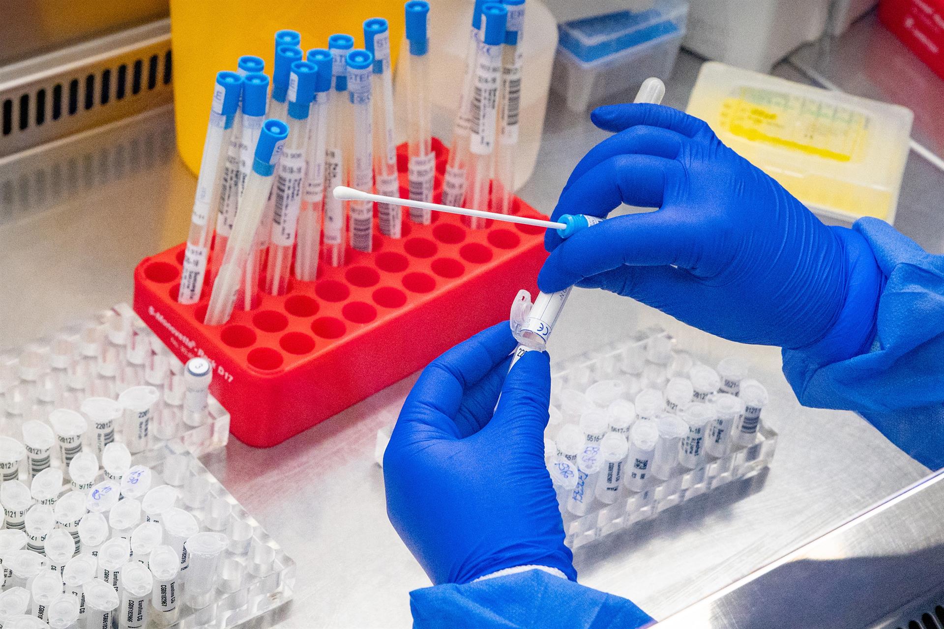 Qué es la fiebre hemorrágica de la que se ha detectado un caso en El Bierzo Qué es la fiebre hemorrágica de la que se ha detectado un caso en El Bierzo