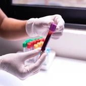 Les infeccions sexuals s'han multiplicat per 10 a Catalunya Les infeccions sexuals s'han multiplicat per 10 a Catalunya