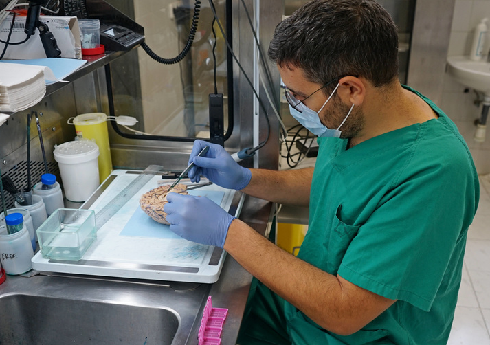 El Banco de Cerebros de la Arrixaca ha recibido casi 300 donaciones desde su puesta en marcha El Banco de Cerebros de la Arrixaca ha recibido casi 300 donaciones desde su puesta en marcha