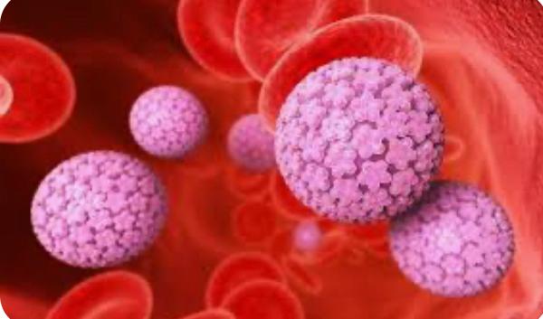 La 'conización' aporta una solución quirúrgica poco invasiva a las lesiones precancerosas de cuello del utero causadas por el VPH La 'conización' aporta una solución quirúrgica poco invasiva a las lesiones precancerosas de cuello del utero causadas por el VPH