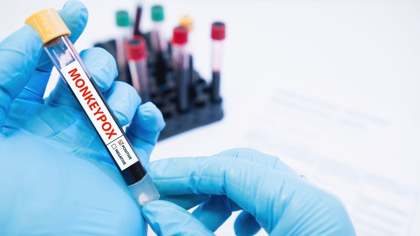 Alerta mundial por mpox: ¿Estamos frente a una nueva pandemia? Alerta mundial por mpox: ¿Estamos frente a una nueva pandemia?