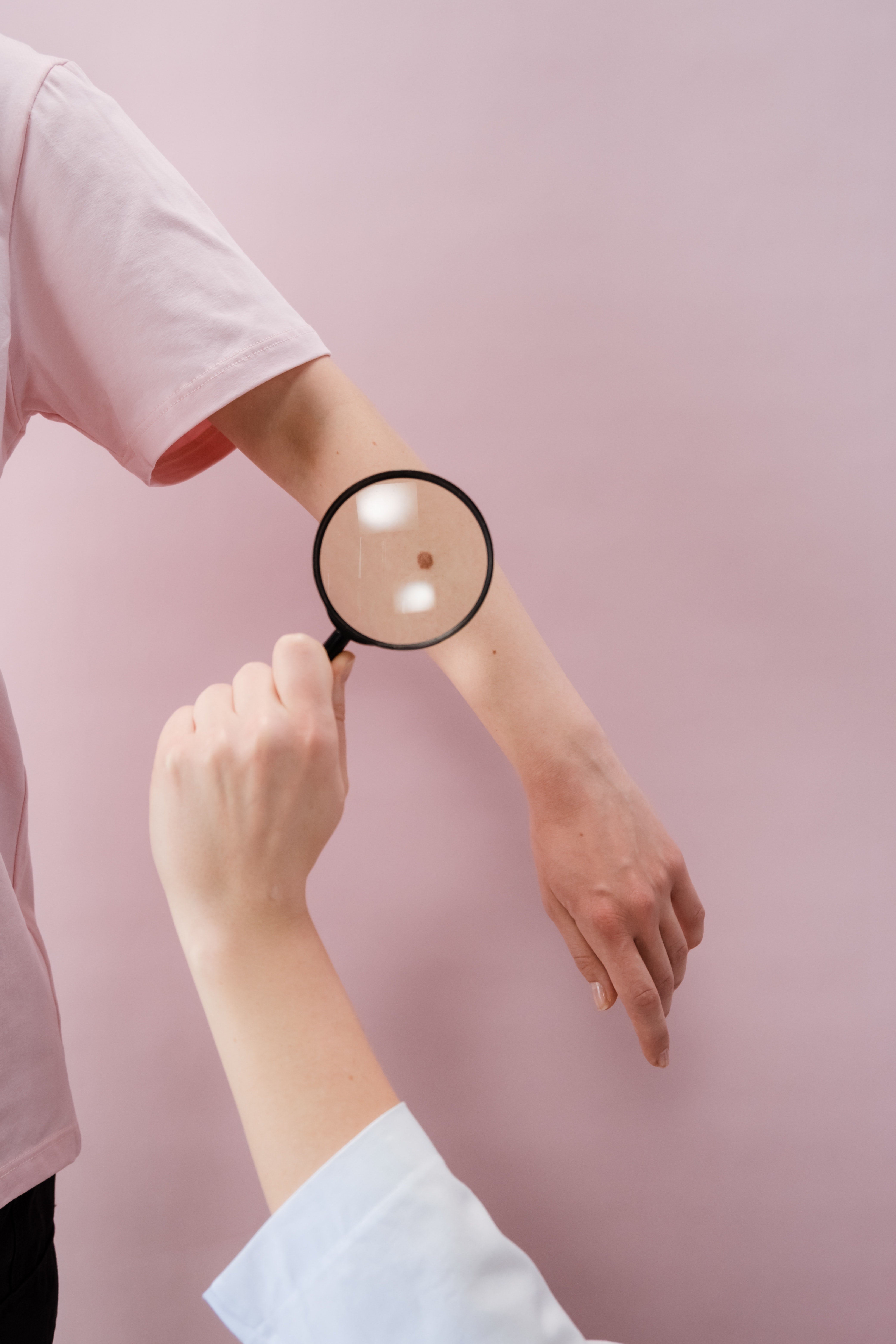 La incidencia del melanoma se dispara: estos son los motivos y cómo prevenirlo La incidencia del melanoma se dispara: estos son los motivos y cómo prevenirlo