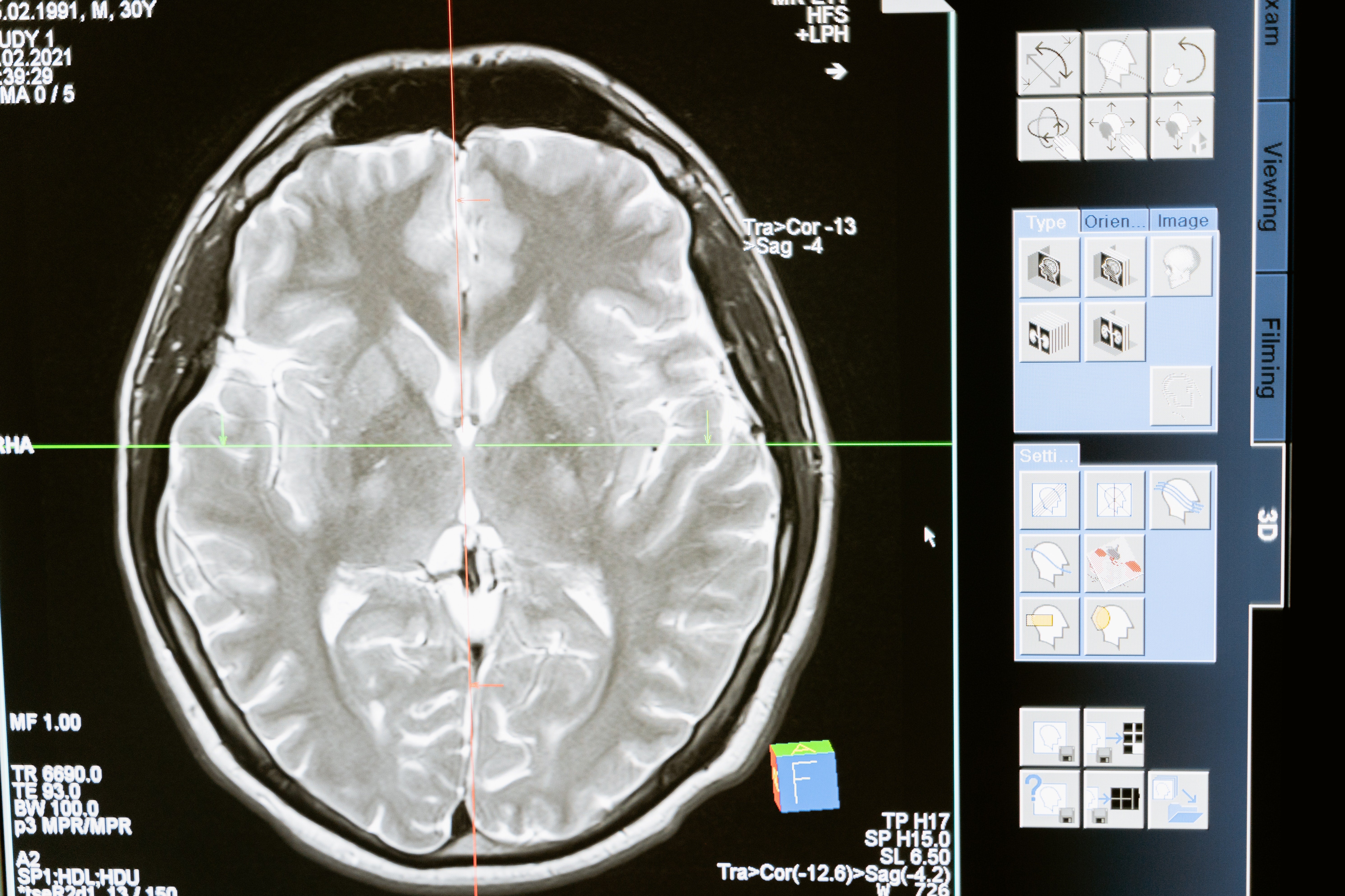 Un estudio muestra los cinco síntomas para detectar el alzhéimer precoz: hasta 9 años antes Un estudio muestra los cinco síntomas para detectar el alzhéimer precoz: hasta 9 años antes