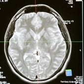 Radiografía de un cerebro humano