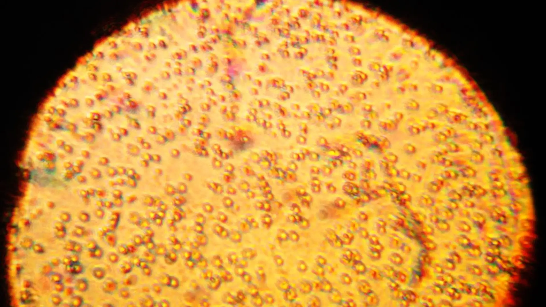 Imagen de leche materna vista con microscopio